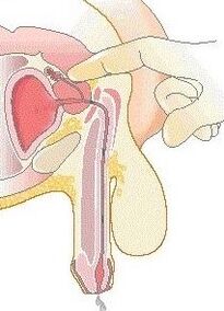 Massage de la prostate